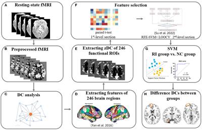 Visual expertise modulates resting-state brain network dynamics in radiologists: a degree centrality analysis